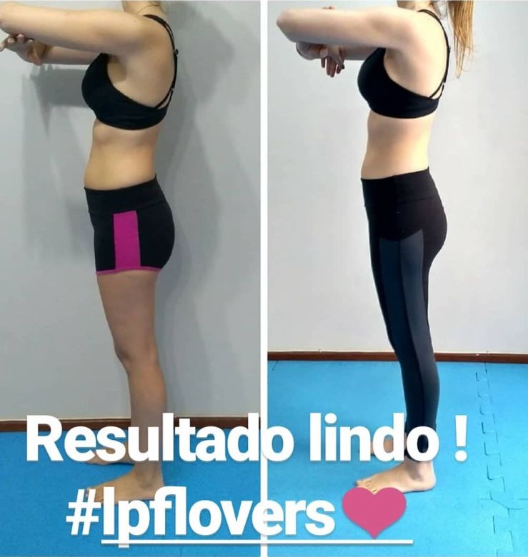 Antes e depois de aluna praticante de LPF, registro já publicado no Instagram.